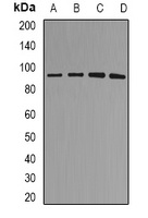 MDM2 Rabbit Polyclonal Antibody