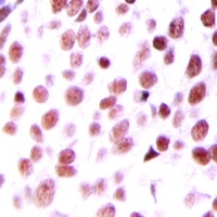 MDM2 Rabbit Polyclonal Antibody