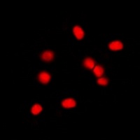 MDM2 Rabbit Polyclonal Antibody