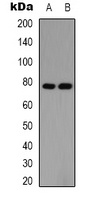 PIAS1 Rabbit Polyclonal Antibody