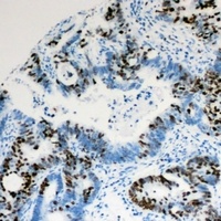 PIAS1 Rabbit Polyclonal Antibody