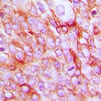 EP2 Rabbit Polyclonal Antibody