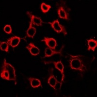 EP2 Rabbit Polyclonal Antibody