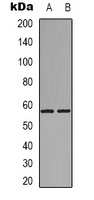 GPR101 Rabbit Polyclonal Antibody