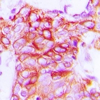 GPR101 Rabbit Polyclonal Antibody