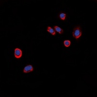 GPR101 Rabbit Polyclonal Antibody