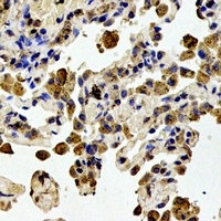 STMN1 (Phospho-S38) Antibody