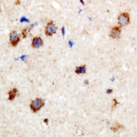 CPI17 (Phospho-T38) Antibody