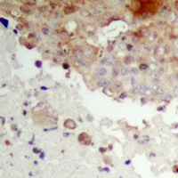 IKB epsilon (Phospho-S22) Antibody