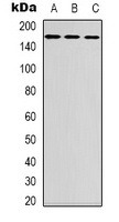 FANCD2 Rabbit Polyclonal Antibody