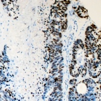 FANCD2 Rabbit Polyclonal Antibody