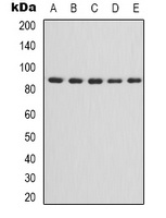 IKK alpha/beta Rabbit Polyclonal Antibody