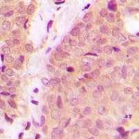 IKK alpha/beta Rabbit Polyclonal Antibody