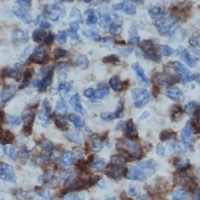 LCK Antibody