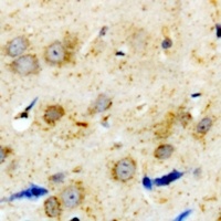 Alpha-1A Adrenergic Receptor Rabbit Polyclonal Antibody