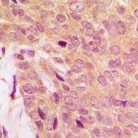 ATP7A Rabbit Polyclonal Antibody