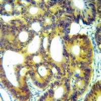 ACE2 Antibody