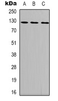 Focal Adhesion Kinase (Phospho-Y407) Rabbit Polyclonal Antibody