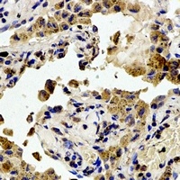 Focal Adhesion Kinase (Phospho-Y407) Rabbit Polyclonal Antibody