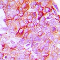 EPHB1/2 Rabbit Polyclonal Antibody