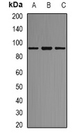 AKAP1 Rabbit Polyclonal Antibody