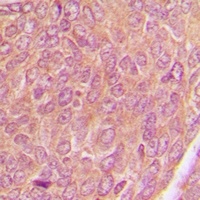 AKAP1 Rabbit Polyclonal Antibody