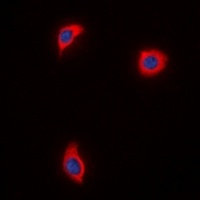AKAP1 Rabbit Polyclonal Antibody