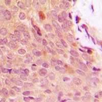 IKB alpha (Phospho-Y42) Antibody