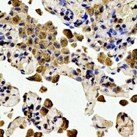 BCL2 (Phospho-T56) Antibody