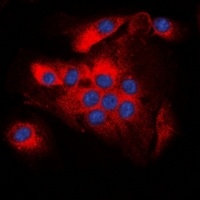 BCL2 (Phospho-T56) Antibody