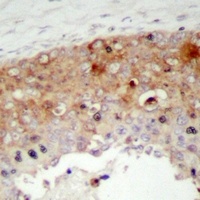 SHCA (Phospho-Y427) Antibody