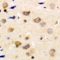 Caldesmon (Phospho-S789) Antibody