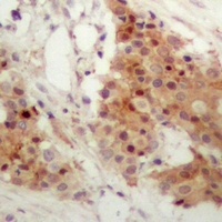 IRF3 (Phospho-S385) Antibody
