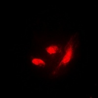 IRF3 (Phospho-S385) Antibody