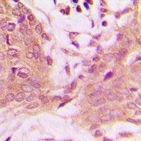PEA15 (Phospho-S116) Antibody