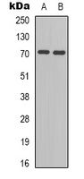 BLNK (Phospho-Y96) Antibody