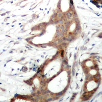 MSK1 (Phospho-S212) Antibody