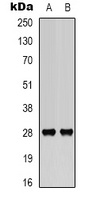 BCL2 (Phospho-S70) Antibody