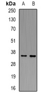 LAT Rabbit Polyclonal Antibody