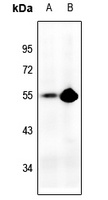 p53 Rabbit Polyclonal Antibody