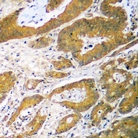 p53 Rabbit Polyclonal Antibody