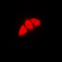 p53 Rabbit Polyclonal Antibody