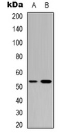 p53 Rabbit Polyclonal Antibody