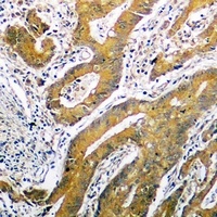 p53 Rabbit Polyclonal Antibody