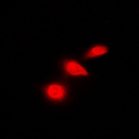 p53 Rabbit Polyclonal Antibody