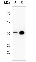 PPP2CA Rabbit Polyclonal Antibody