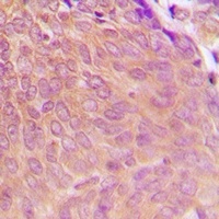 PPP2CA Rabbit Polyclonal Antibody
