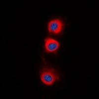PPP2CA Rabbit Polyclonal Antibody
