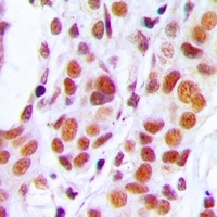 RB1 Rabbit Polyclonal Antibody