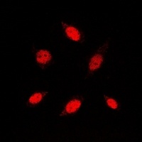 RB1 Rabbit Polyclonal Antibody